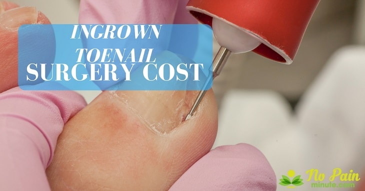 ingrown toenail surgery cost