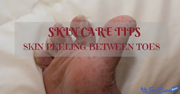 How To Cure My Skin Peeling Between Toes? How To Cure My Skin Peeling Between Toes?