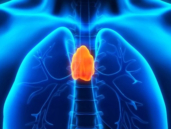 Thymic carcinoma